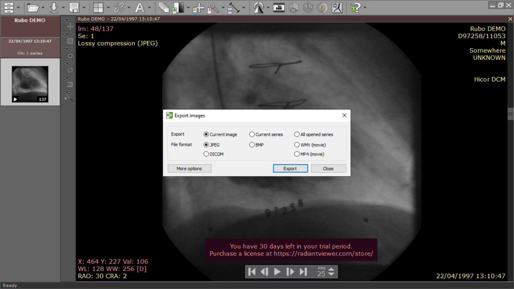 RadiAnt DICOM Viewer Export images